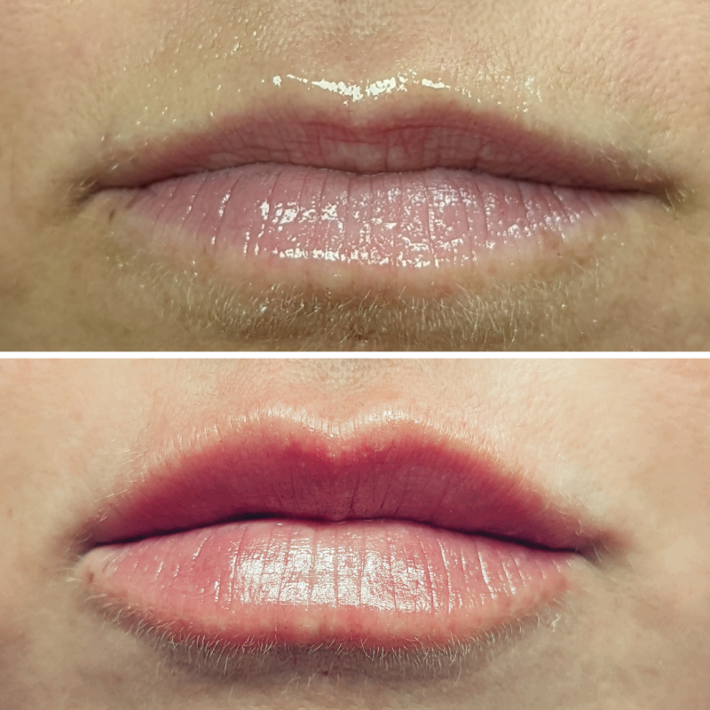 Home Kamloops Skin Solutions