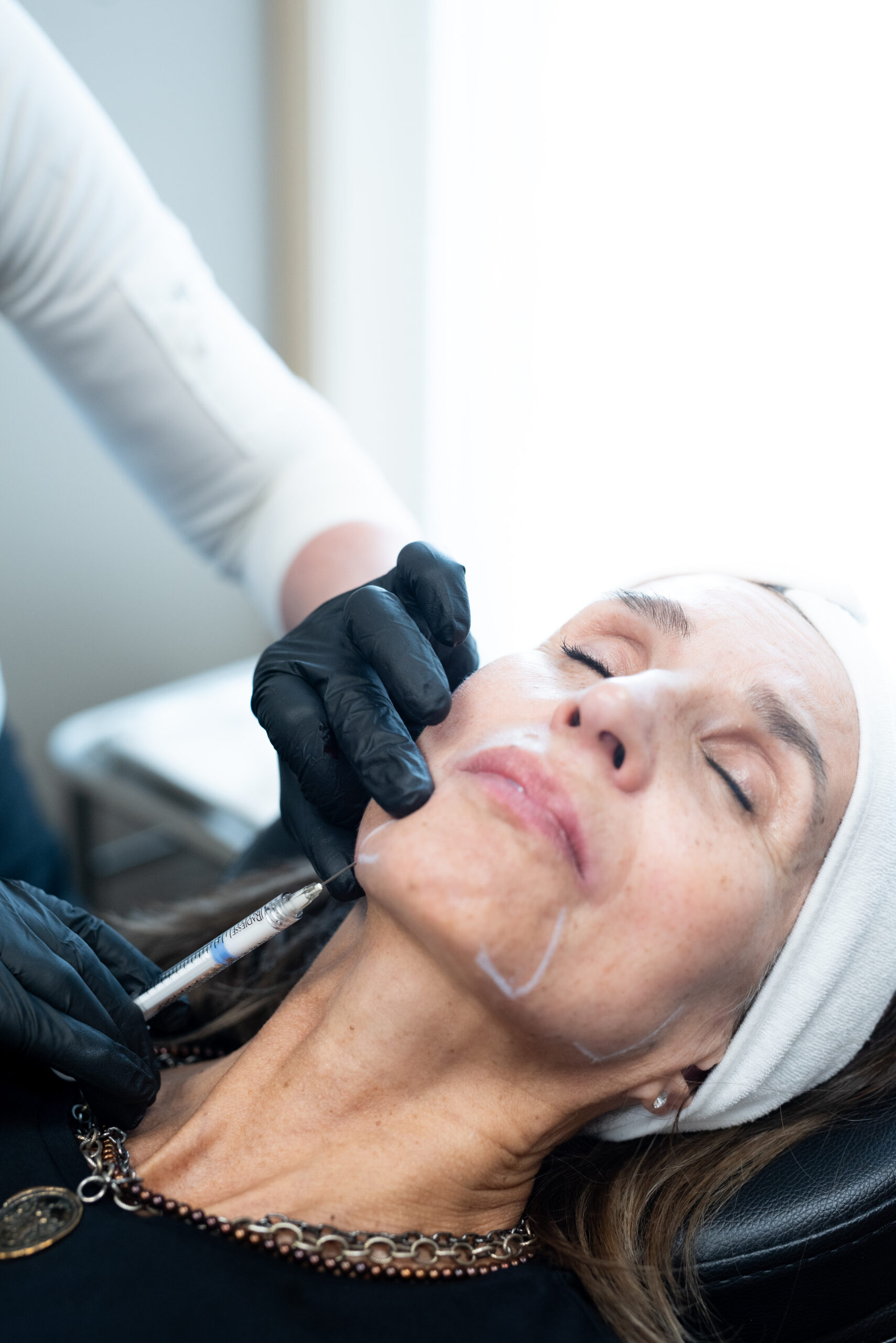 Woman getting a Radiesse Treatment at Kamloops Skin Solutions