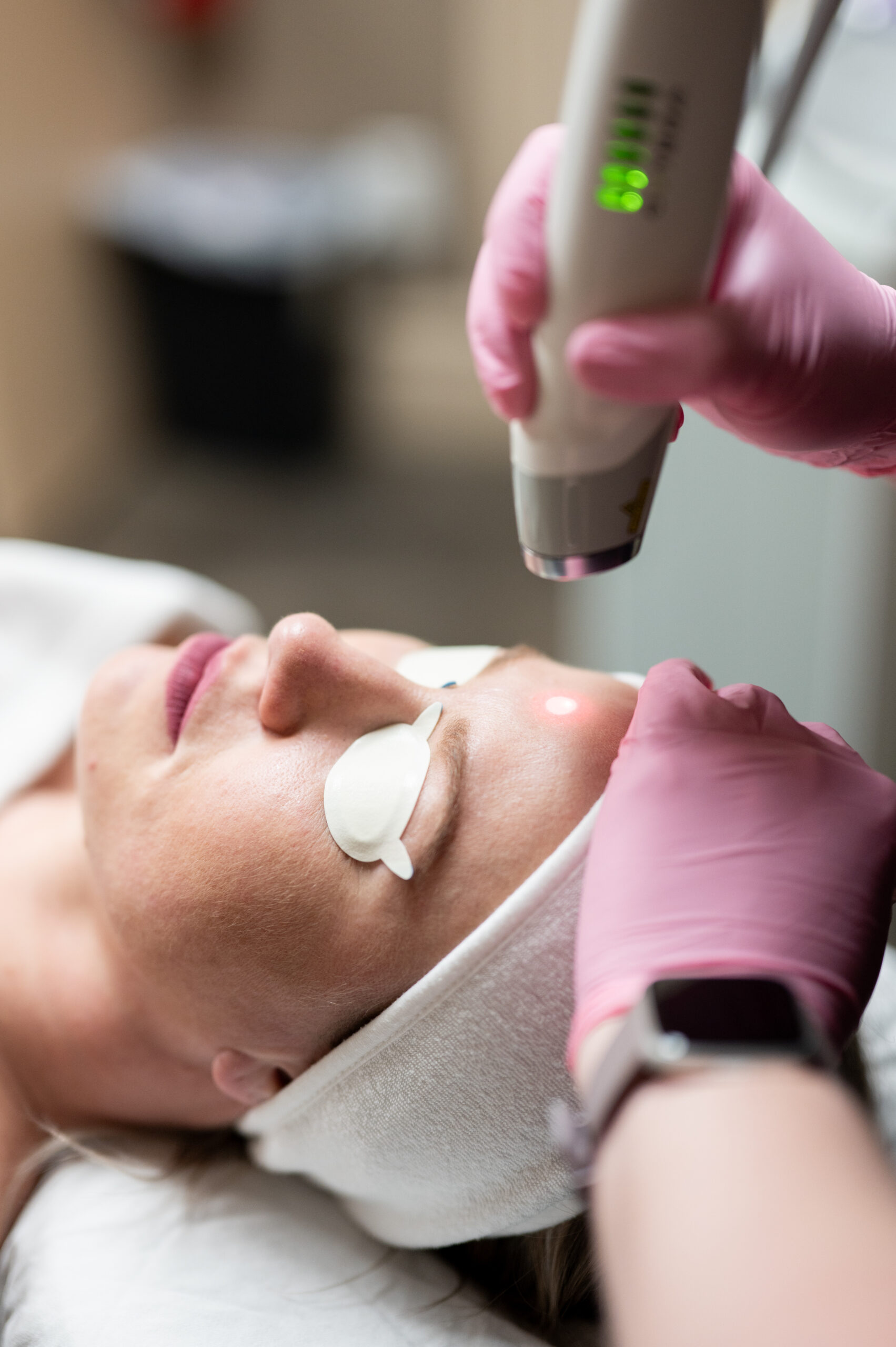 Woman getting a Laser Genesis Treatment at Kamloops Skin Solutions