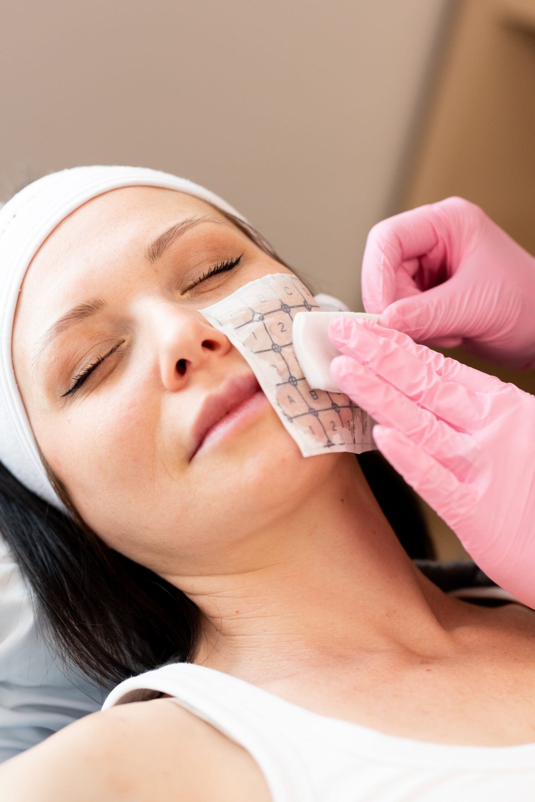 Kamloops Skin Solutions Woman getting a Thermage Treatment at Kamloops Skin Solutions