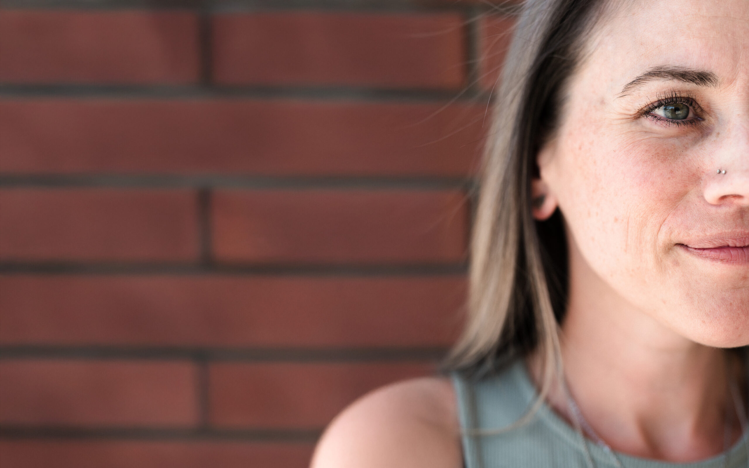 Close-up of facial skin showing pigmentation and melasma on the cheek at Kamloops Skin Solutions.