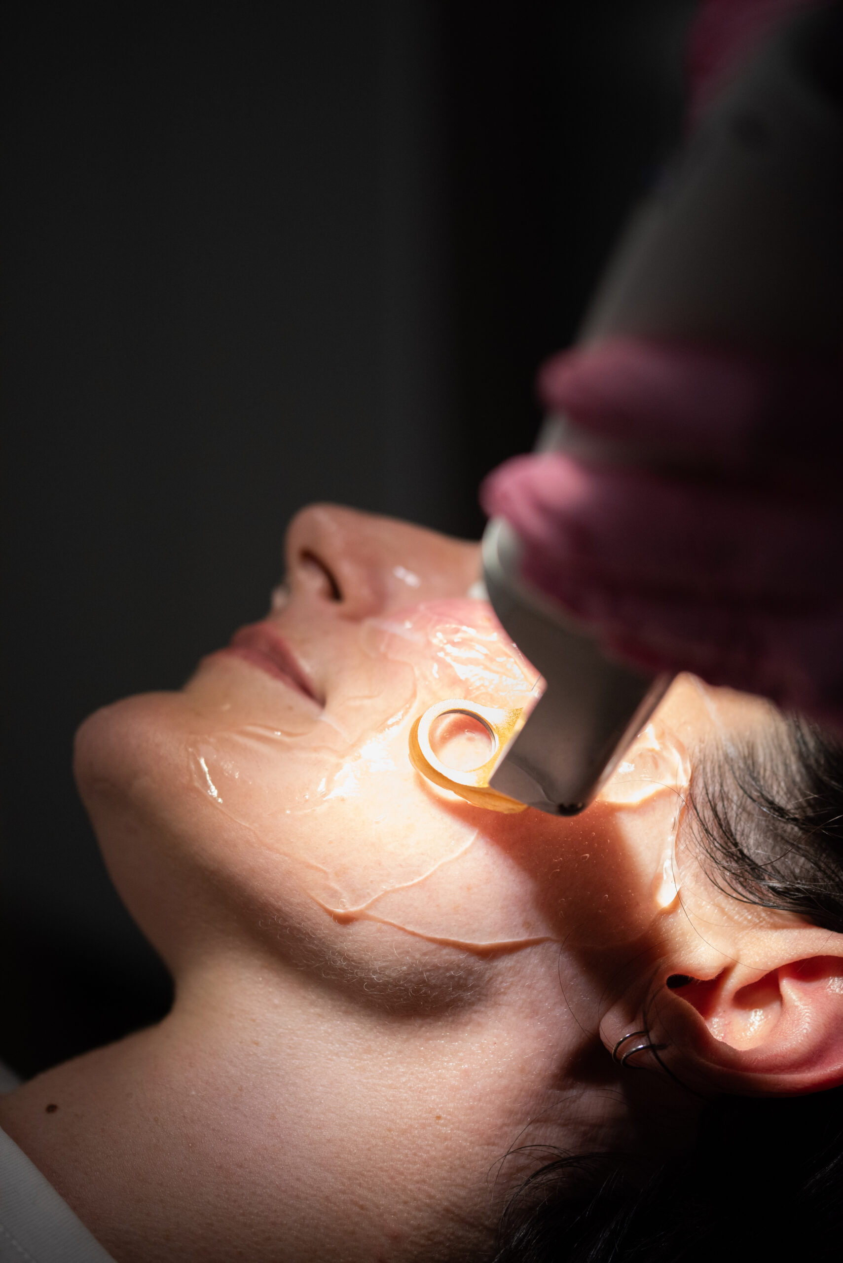 Close-up of skin treatment used to improve skin tone and complexion at Kamloops Skin Solutions.