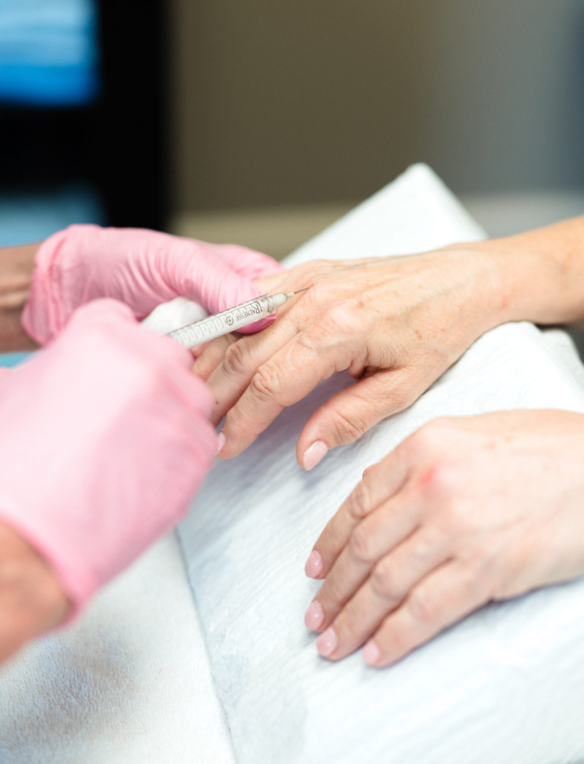 Dermal filler injection being performed on the hands to restore volume at Kamloops Skin Solutions.