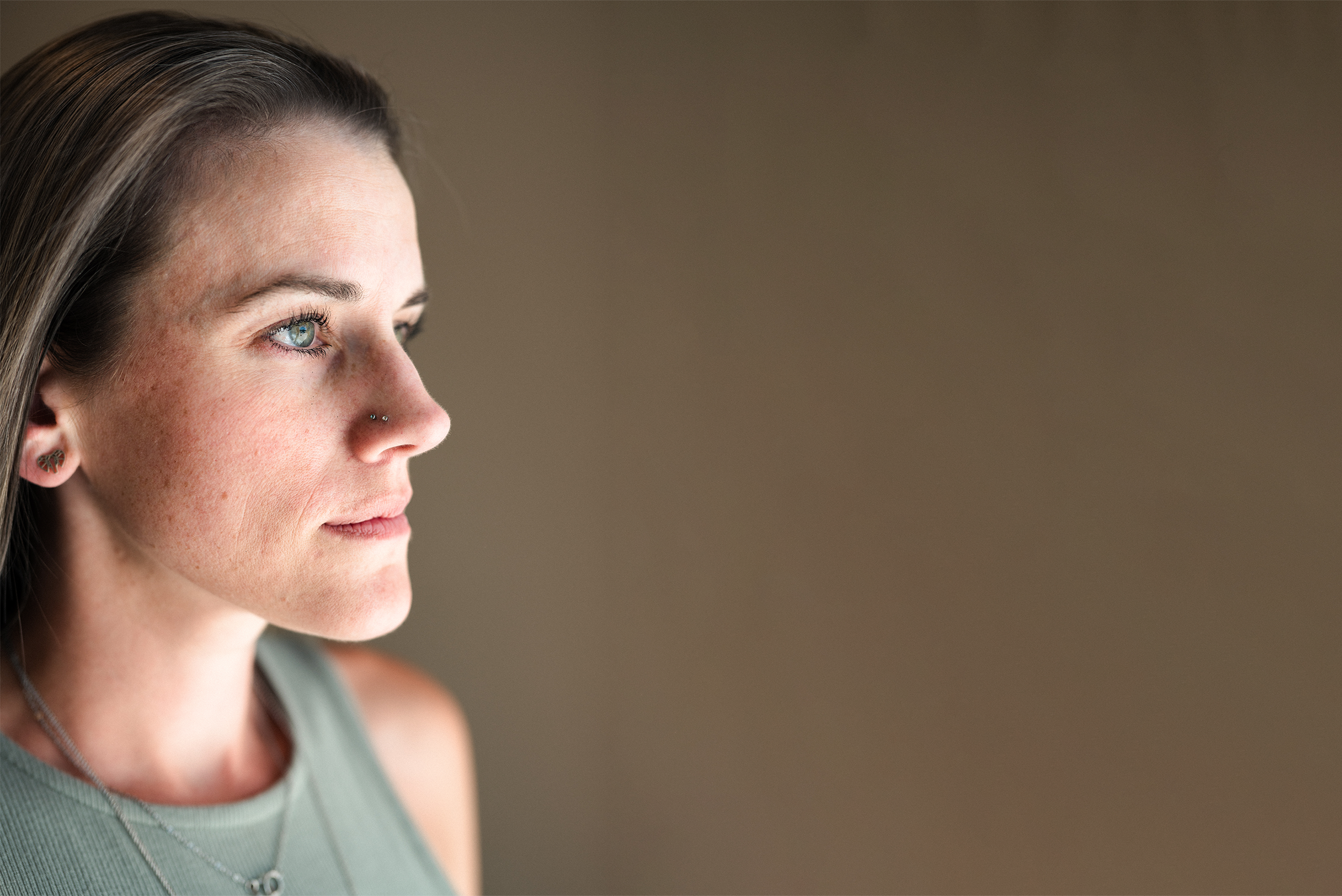 Conditions Image 2 Different skin conditions supported at Kamloops Skin Solutions